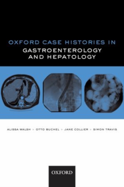 Oxford Case Histories in Gastroenterology and Hepatology, Paperback / softback Book