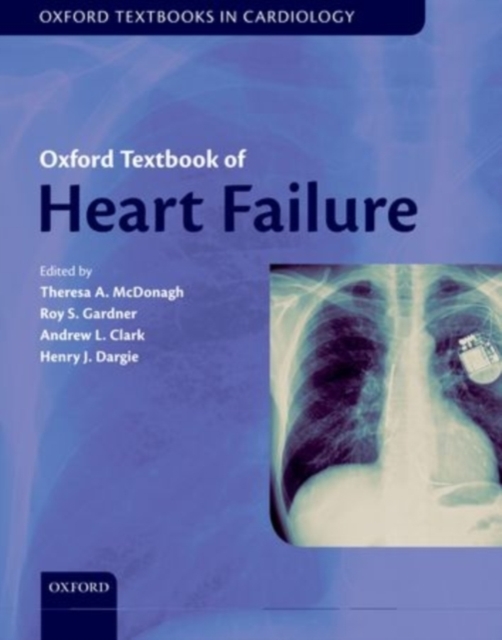 Oxford Textbook of Heart Failure, Hardback Book