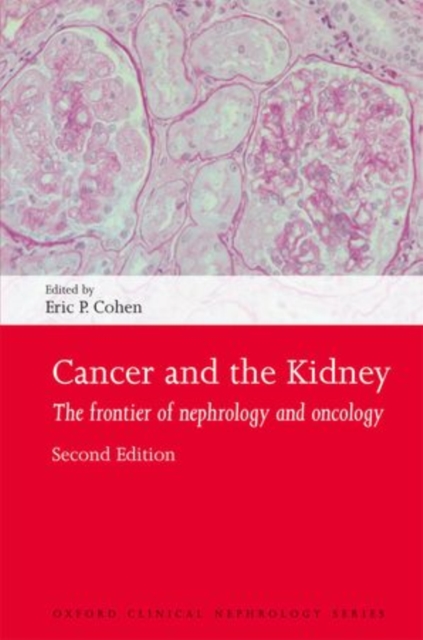 Cancer and the Kidney : The frontier of nephrology and oncology, Paperback / softback Book
