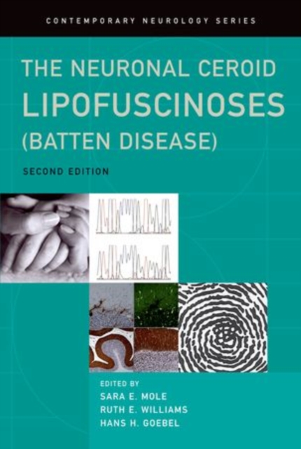 The Neuronal Ceroid Lipofuscinoses (Batten Disease), Hardback Book