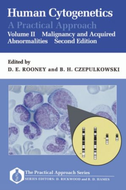 Human Cytogenetics: A Practical Approach: Volume II: Malignancy and Acquired Abnormalities, Paperback / softback Book