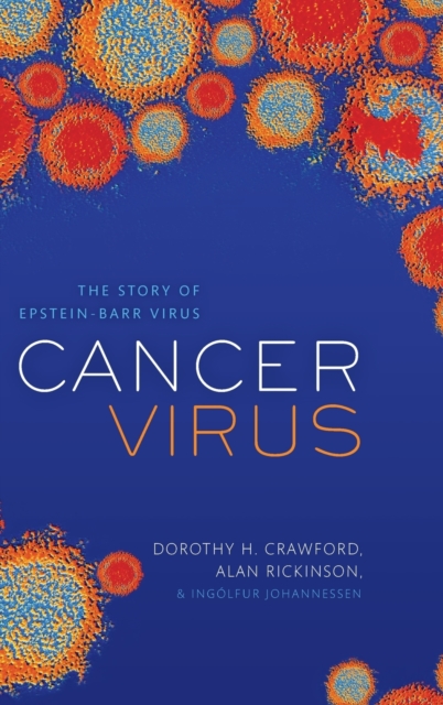 Cancer Virus : The story of Epstein-Barr Virus, Hardback Book