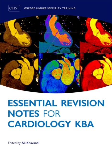 Essential Revision Notes for Cardiology KBA, Paperback / softback Book