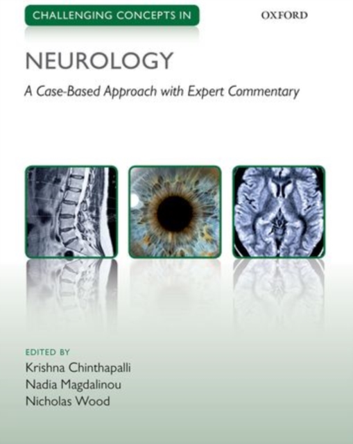 Challenging Concepts in Neurology : Cases with Expert Commentary, Paperback / softback Book