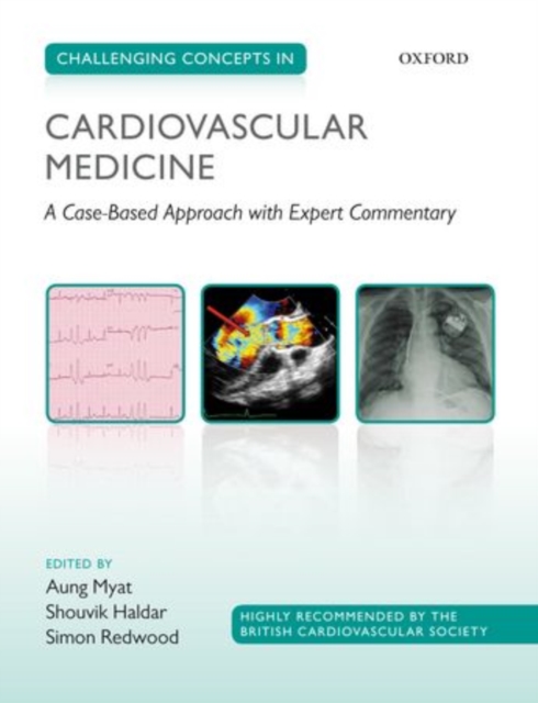 Challenging Concepts in Cardiovascular Medicine : A Case-Based Approach with Expert Commentary, Paperback / softback Book