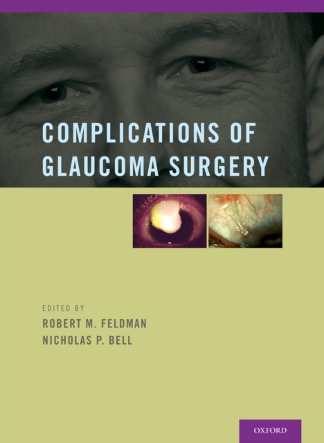 Complications of Glaucoma Surgery, PDF eBook