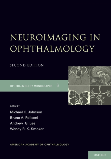Neuroimaging in Ophthalmology, PDF eBook