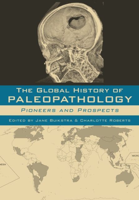 The Global History of Paleopathology : Pioneers and Prospects, PDF eBook