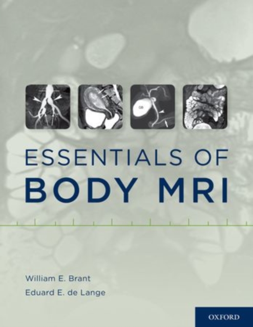 Essentials of Body MRI, Hardback Book