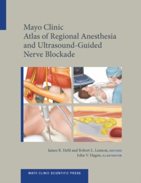 Mayo Clinic Atlas of Regional Anesthesia and Ultrasound-Guided Nerve Blockade, Hardback Book