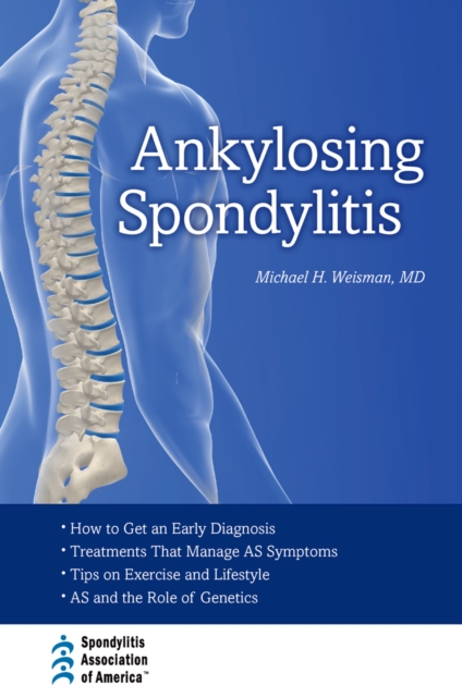 Ankylosing Spondylitis, PDF eBook