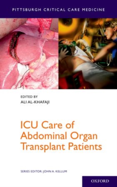 ICU Care of Abdominal Organ Transplant Patients, Paperback / softback Book