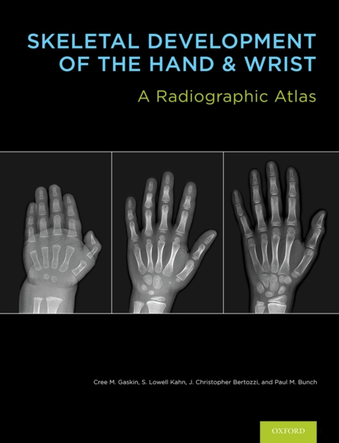 Skeletal Development of the Hand and Wrist : A Radiographic Atlas and Digital Bone Age Companion, PDF eBook