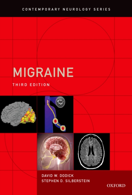 Migraine, PDF eBook