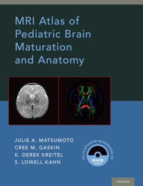 MRI Atlas of Pediatric Brain Maturation and Anatomy, Hardback Book