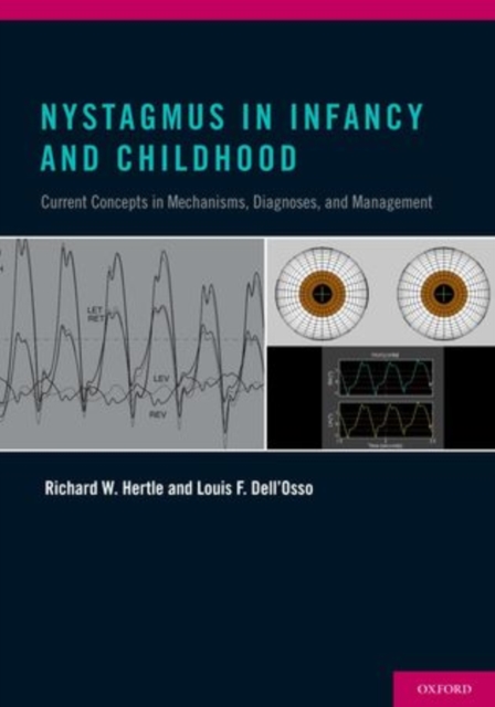 Nystagmus In Infancy and Childhood : Current Concepts in Mechanisms, Diagnoses, and Management, Hardback Book