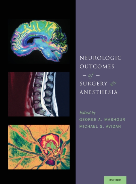 Neurologic Outcomes of Surgery and Anesthesia, Hardback Book