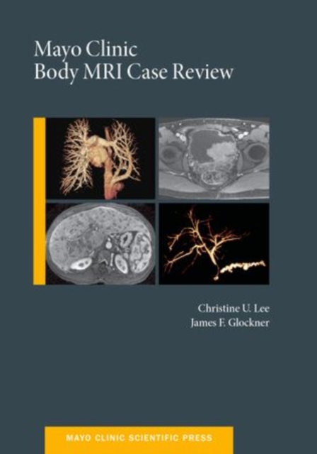 Mayo Clinic Body MRI Case Review, Hardback Book