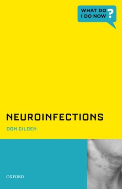 Neuroinfections, Paperback / softback Book
