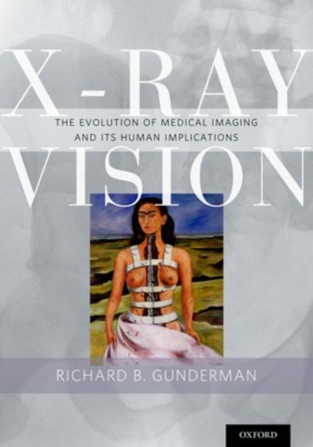 X-Ray Vision : The Evolution of Medical Imaging and Its Human Significance, Paperback / softback Book