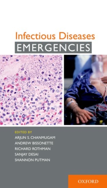 Infectious Diseases Emergencies, Paperback / softback Book