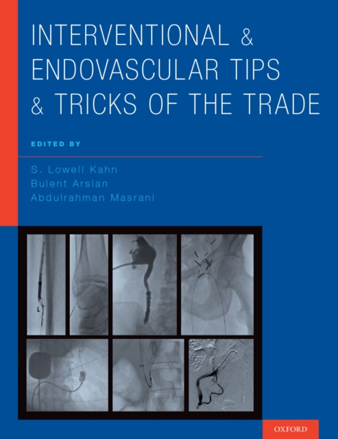 Interventional and Endovascular Tips and Tricks of the Trade, EPUB eBook