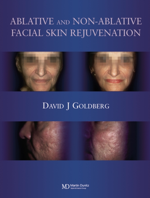 Ablative and Non-ablative Facial Skin Rejuvenation, PDF eBook