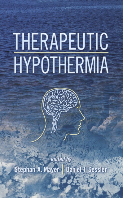 Therapeutic Hypothermia, PDF eBook