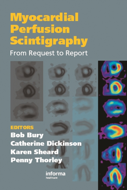 Myocardial Perfusion Scintigraphy : From Request to Report, PDF eBook
