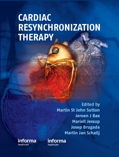 Cardiac Resynchronization Therapy, PDF eBook