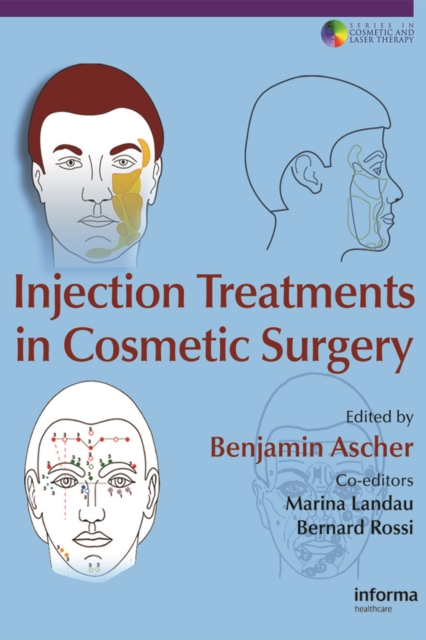 Injection Treatments in Cosmetic Surgery, PDF eBook