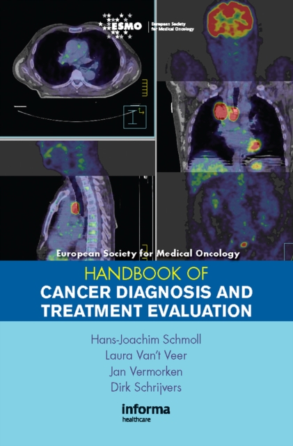 ESMO Handbook of Cancer Diagnosis and Treatment Evaluation, PDF eBook
