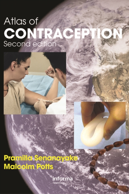 Atlas of Contraception, PDF eBook