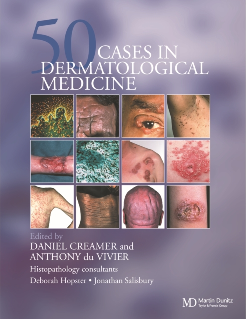 Fifty Dermatological Cases, PDF eBook