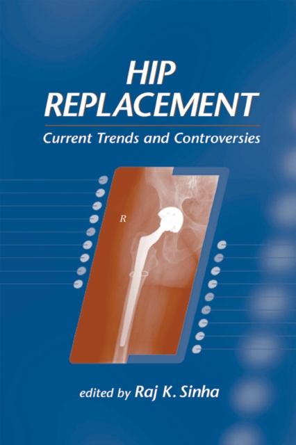 Hip Replacement : Current Trends and Controversies, PDF eBook