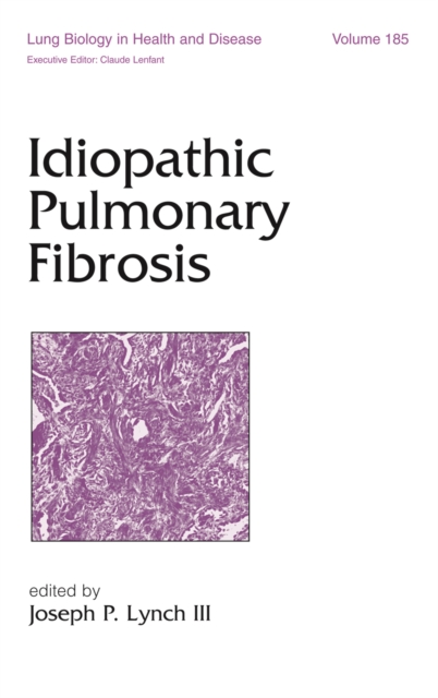Idiopathic Pulmonary Fibrosis, PDF eBook