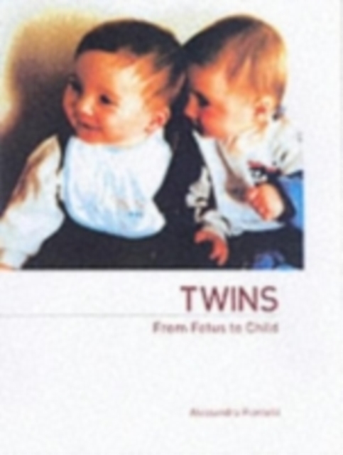 Twins - From Fetus to Child, PDF eBook