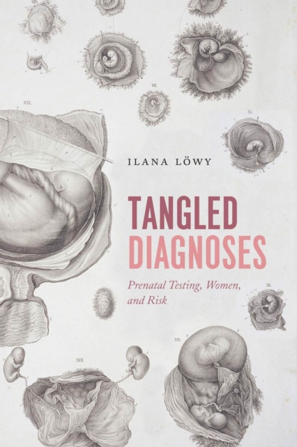 Tangled Diagnoses : Prenatal Testing, Women, and Risk, Paperback / softback Book