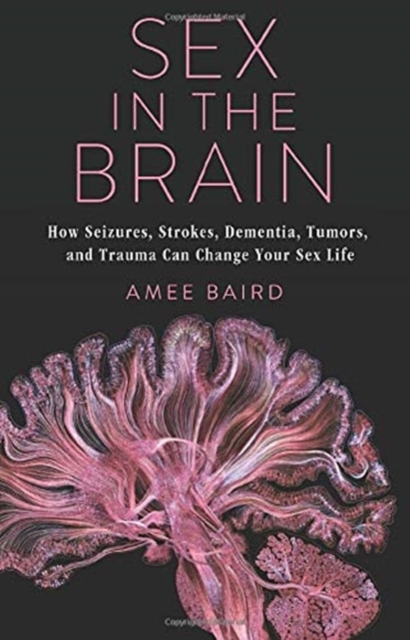 Sex in the Brain : How Seizures, Strokes, Dementia, Tumors, and Trauma Can Change Your Sex Life, Hardback Book