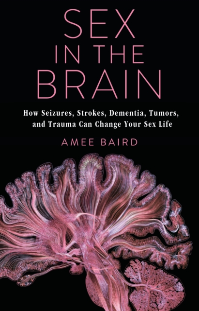 Sex in the Brain : How Seizures, Strokes, Dementia, Tumors, and Trauma Can Change Your Sex Life, EPUB eBook