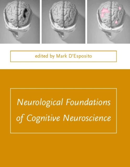 Neurological Foundations of Cognitive Neuroscience, PDF eBook
