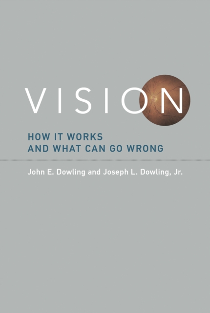 Vision : How It Works and What Can Go Wrong, Paperback / softback Book