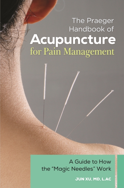 The Praeger Handbook of Acupuncture for Pain Management : A Guide to How the "Magic Needles" Work, EPUB eBook