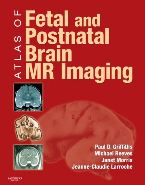 Atlas of Fetal and Postnatal Brain MR, Hardback Book