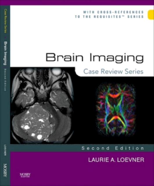 Brain Imaging: Case Review Series : Brain Imaging: Case Review Series E-Book, PDF eBook