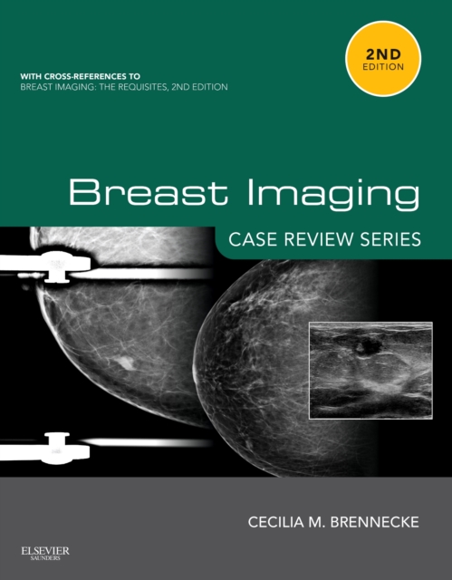 Breast Imaging: Case Review Series E-Book, EPUB eBook