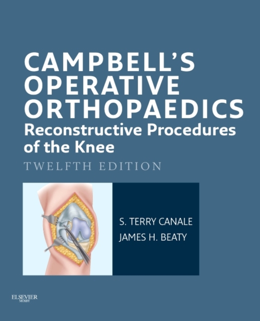 Campbell's Operative Orthopaedics: Reconstructive Procedures of the Knee E-Book, EPUB eBook