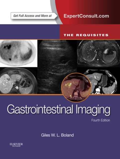 Gastrointestinal Imaging: The Requisites E-Book, EPUB eBook