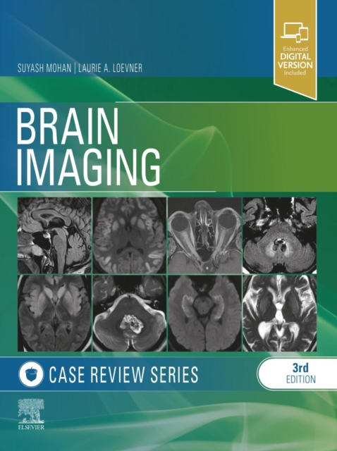 Brain Imaging: Case Review Series E-Book, EPUB eBook