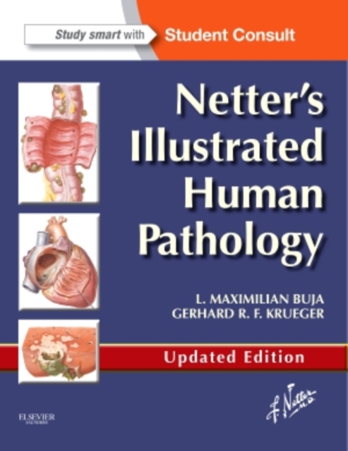 Netter's Illustrated Human Pathology Updated Edition : with Student Consult Access, Paperback / softback Book